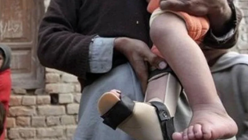 PMA concerned over reporting of polio case from Balochistan
