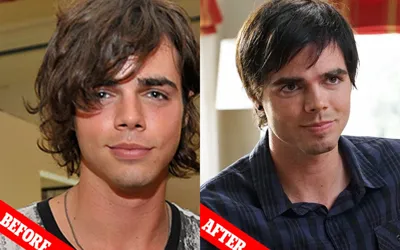 When Dylan Reid Ewing revealed his struggles with plastic surgery to look like Brad Pitt