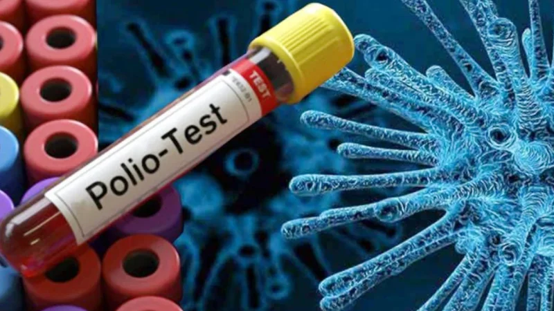 Poliovirus detected in sewerage samples of all four provinces
