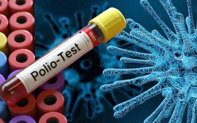 Poliovirus detected in sewerage samples of all four provinces