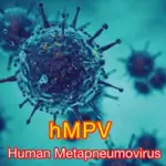 Human metapneumovirus alert issued in Kotli