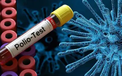 Poliovirus confirmed in environmental samples of 12 districts