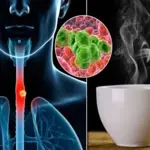 Tea and Coffee lovers beware as study warns extremely hot drinks may raise 'Esophageal Cancer' risk