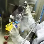 Japan performs world's first stem cell transplant for Parkinson’s patient
