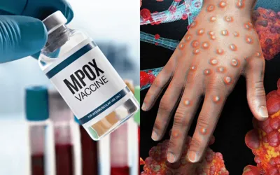Nigeria reports 39 new Mpox cases this year