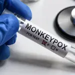 KP confirms third Monkeypox Case