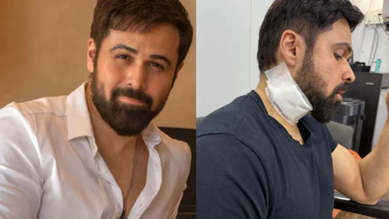 Emraan Hashmi sustains injuries while shooting for ‘Goodachari 2’