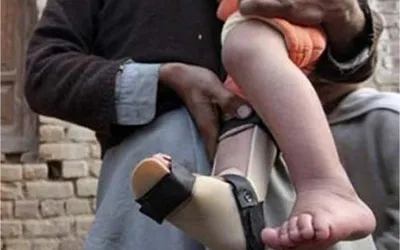 Polio cases reported in eight districts across Pakistan