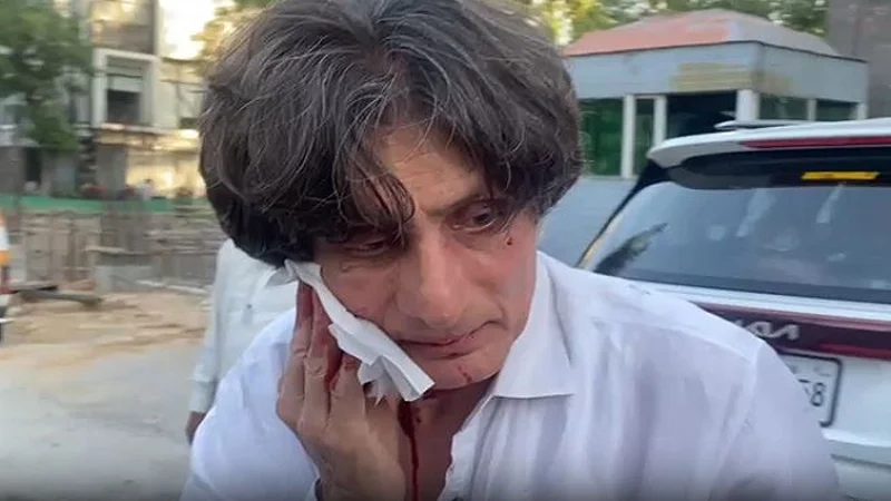 PTI leader Rauf Hassan injured in knife attack