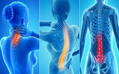 Three easy exercises to help reduce back pain