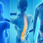 Three easy exercises to help reduce back pain