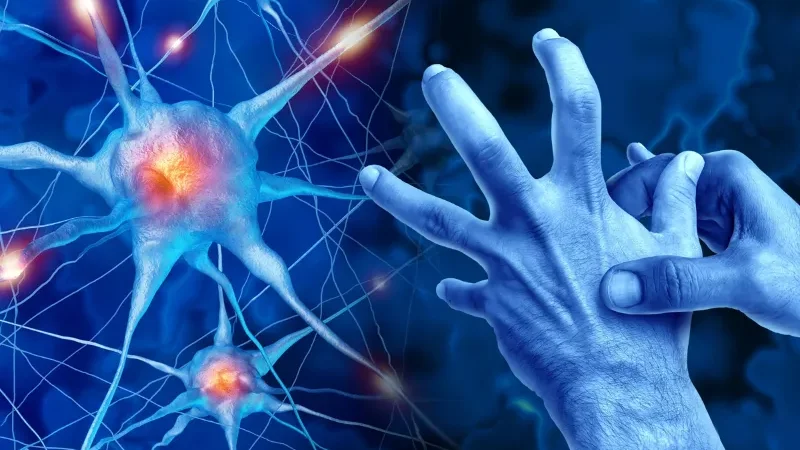 parkinson (2)
