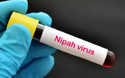 Nipah virus poses no immediate threat to Pakistan, say health experts