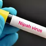 Nipah virus poses no immediate threat to Pakistan, say health experts