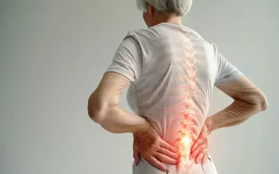 Five habits to help prevent Osteoporosis