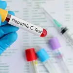 Hepatitis C free screening and treatment programme announced